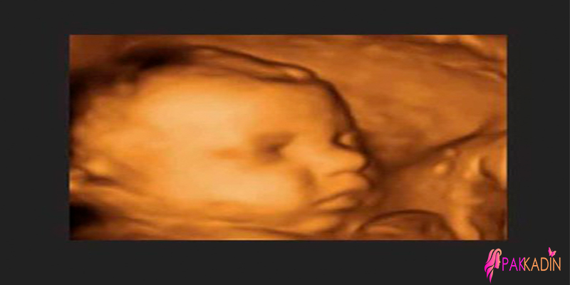 31. Hafta Gebelik Ultrason Görüntüleri