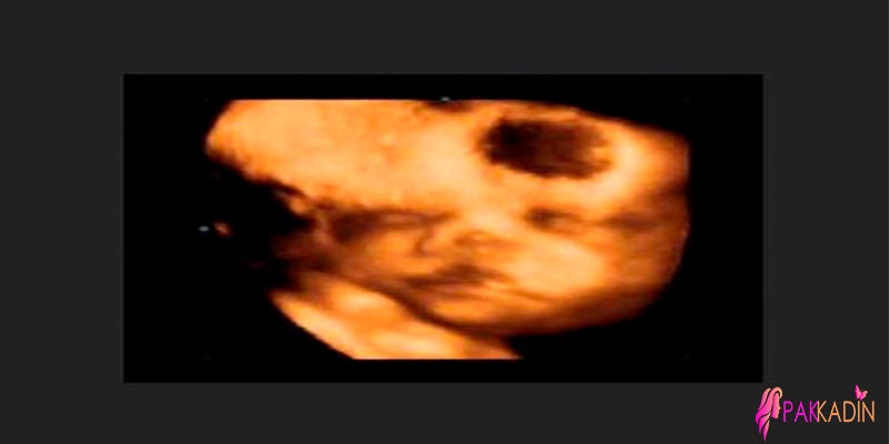 Hamilelikte 9. Ay Nasıl Geçer?
