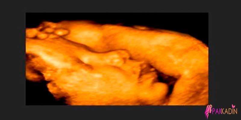36. Hafta Gebelik Ultrason Görüntüleri