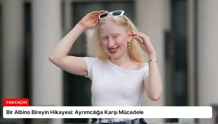 Bir Albino Bireyin Hikayesi: Ayrımcılığa Karşı Mücadele