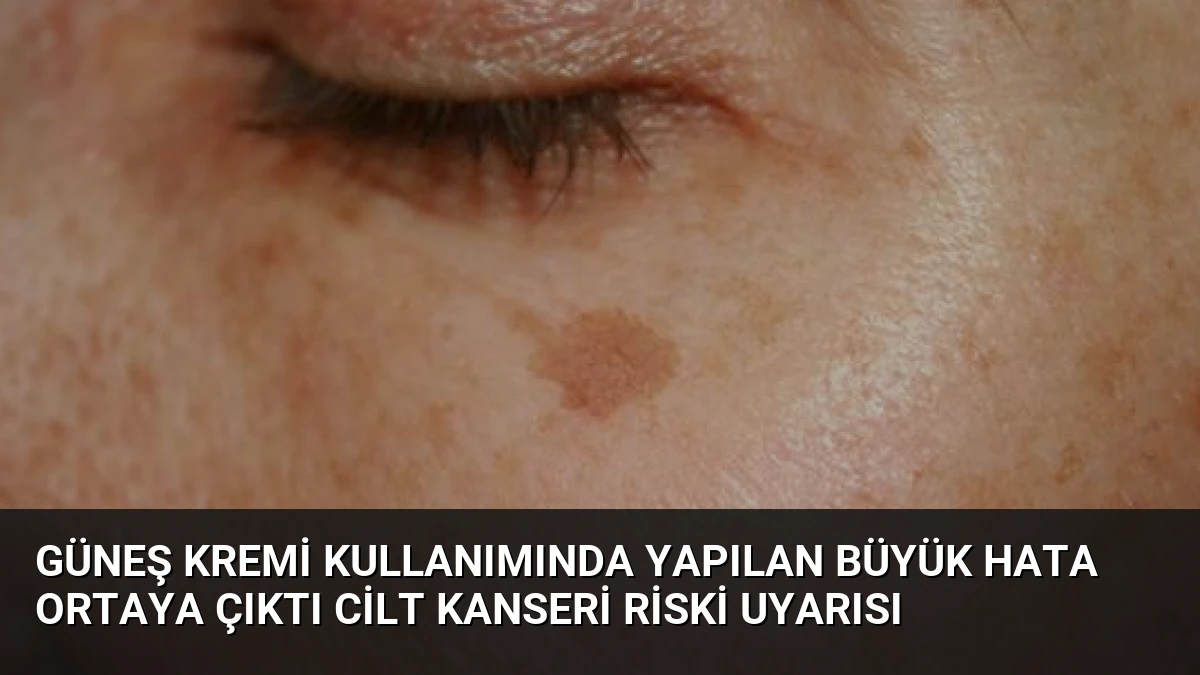 Güneş Kremi Kullanımında Yapılan Büyük Hata Ortaya Çıktı Cilt Kanseri Riski Uyarısı