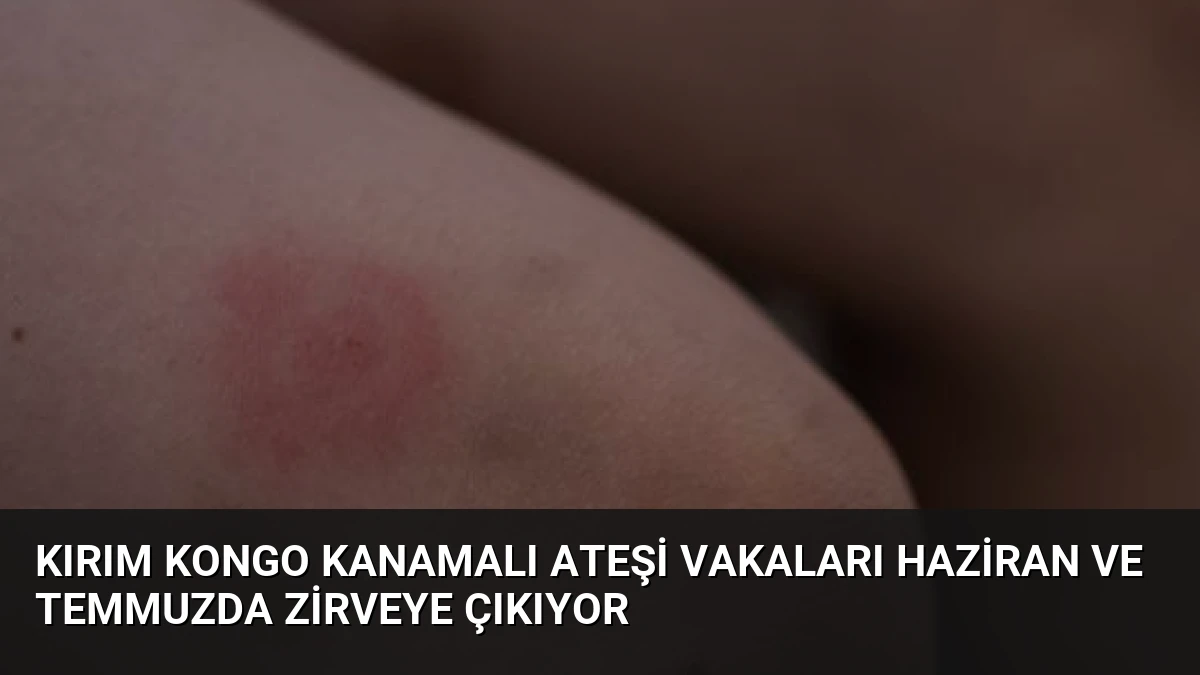 Kırım Kongo Kanamalı Ateşi Vakaları Haziran ve Temmuzda Zirveye Çıkıyor