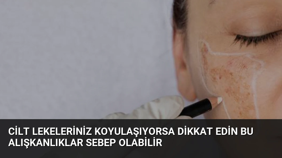 Cilt Lekeleriniz Koyulaşıyorsa Dikkat Edin Bu Alışkanlıklar Sebep Olabilir