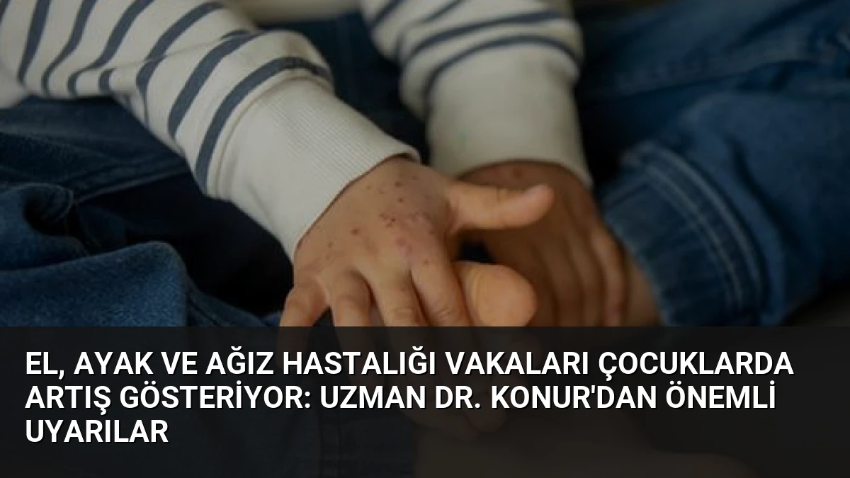 El, Ayak ve Ağız Hastalığı Vakaları Çocuklarda Artış Gösteriyor: Uzman Dr. Konur’dan Önemli Uyarılar