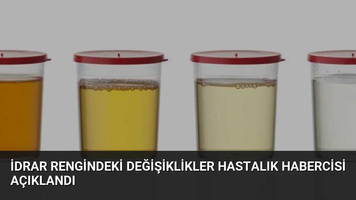 İdrar Rengindeki Değişiklikler Hastalık Habercisi Açıklandı