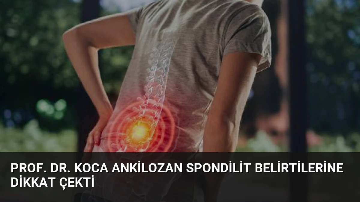 Prof. Dr. Koca Ankilozan Spondilit Belirtilerine Dikkat Çekti