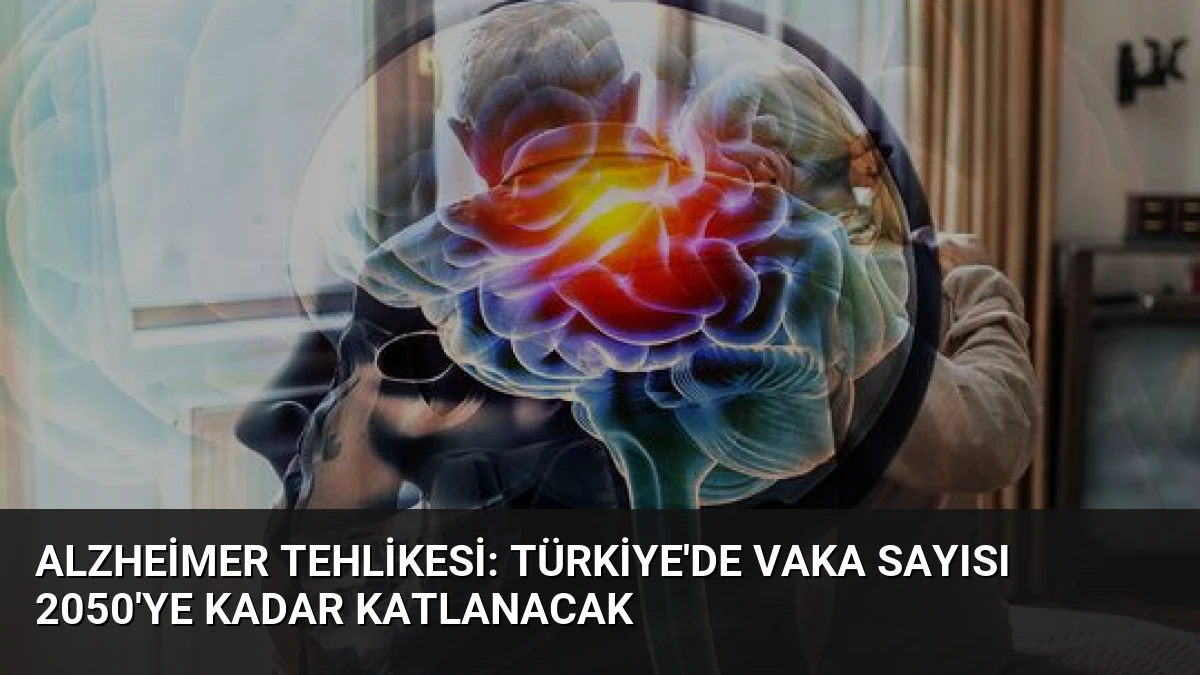 Alzheimer Tehlikesi: Türkiye’de Vaka Sayısı 2050’ye Kadar Katlanacak