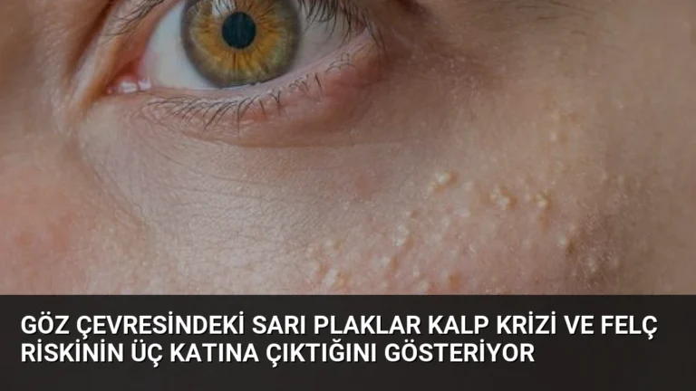 Göz Çevresindeki Sarı Plaklar Kalp Krizi ve Felç Riskinin Üç Katına Çıktığını Gösteriyor