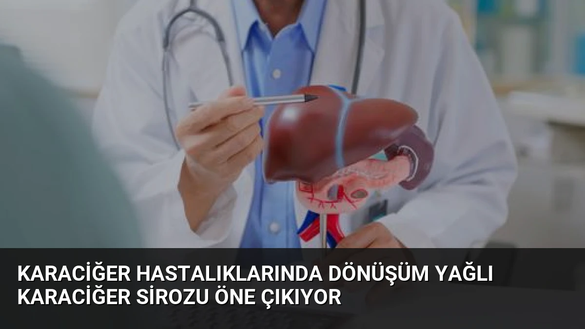 Karaciğer Hastalıklarında Dönüşüm Yağlı Karaciğer Sirozu Öne Çıkıyor