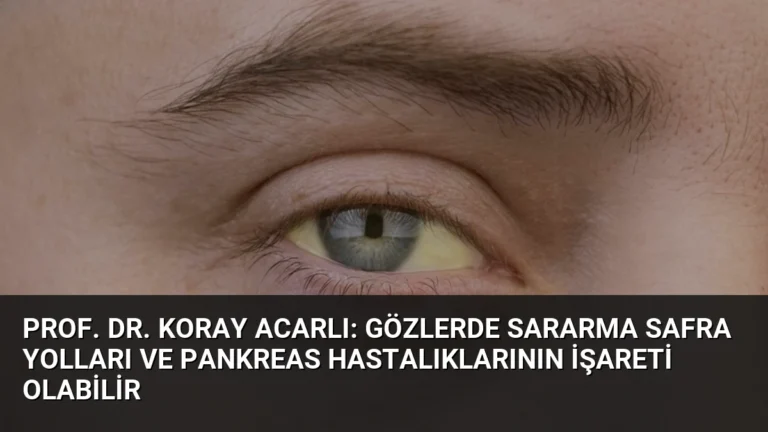 Prof. Dr. Koray Acarlı: Gözlerde Sararma Safra Yolları ve Pankreas Hastalıklarının İşareti Olabilir