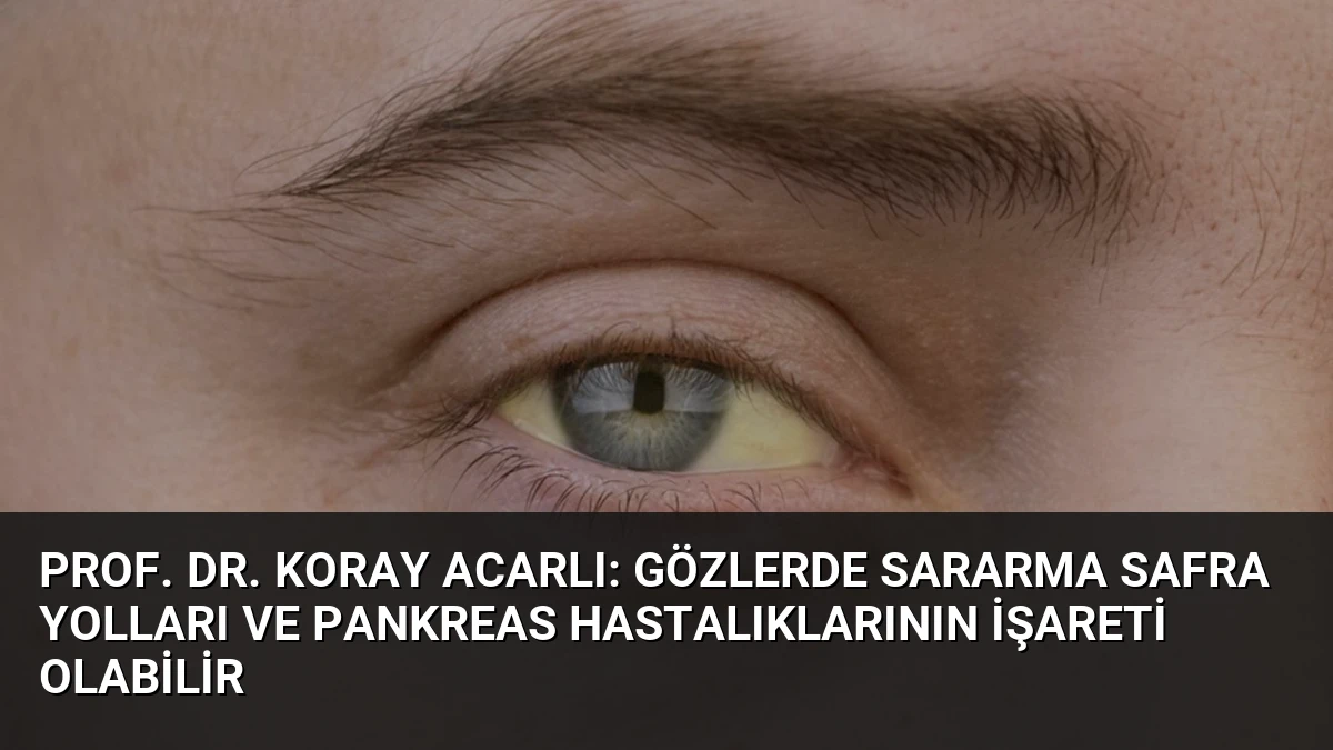 Prof. Dr. Koray Acarlı: Gözlerde Sararma Safra Yolları ve Pankreas Hastalıklarının İşareti Olabilir