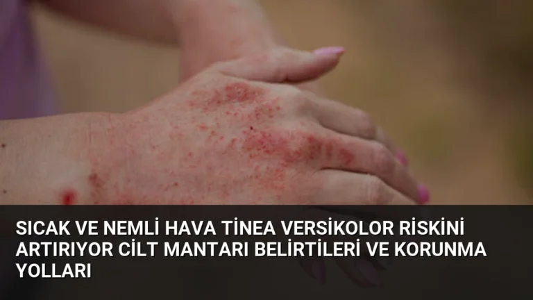 Sıcak ve Nemli Hava Tinea Versikolor Riskini Artırıyor Cilt Mantarı Belirtileri ve Korunma Yolları