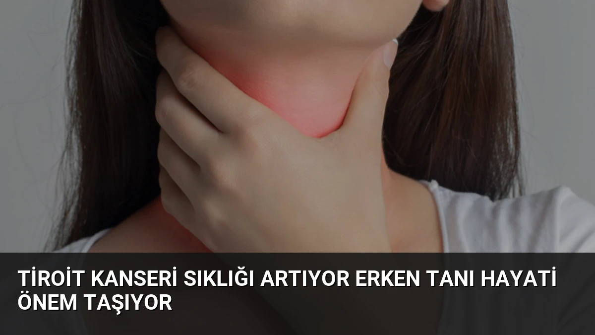 Tiroit Kanseri Sıklığı Artıyor Erken Tanı Hayati Önem Taşıyor